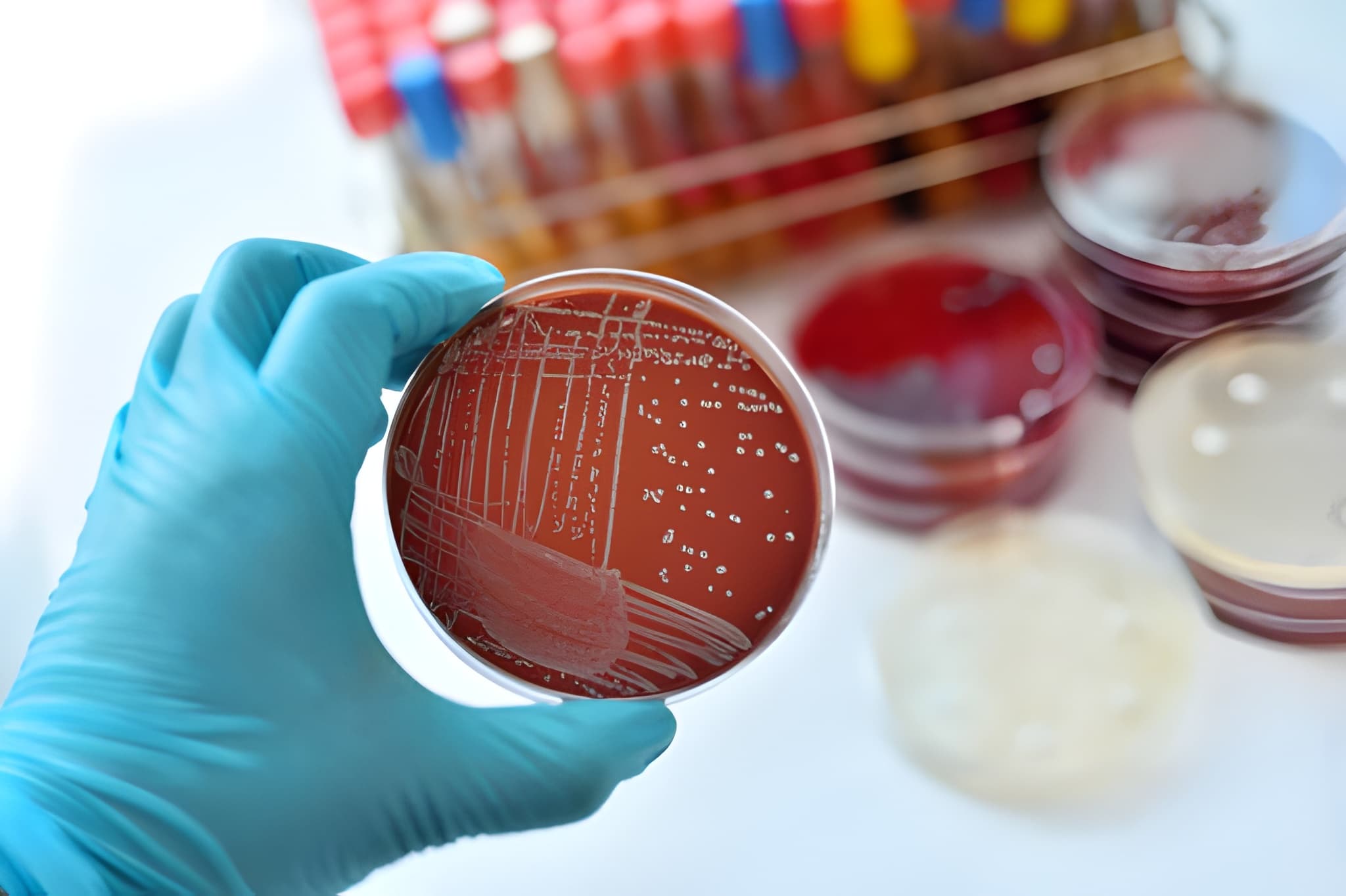 Bacteriología y Parasitología